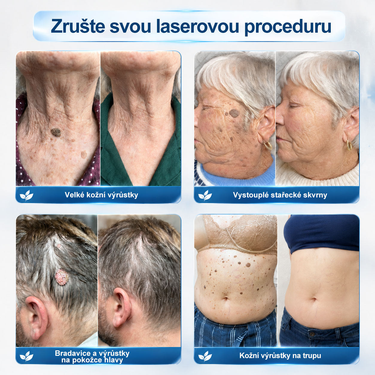 Oficiální značkový obchod |👩‍⚕️𝐏𝐢𝐜𝑑𝑜® 𝟩𝖽𝖾𝗻𝗻í 𝘰𝘥𝘴𝘵𝗋𝖺ň𝗈𝗏𝖺č 𝒔𝒌𝒗𝒓𝙣 𝙖 𝙥𝙞𝙜𝙢𝙚𝙣𝙩𝘰𝘷ý𝘤𝘩 𝘴𝘬𝖛𝖗𝖓 (Bezbolestný rollerball bez jizev)✈️