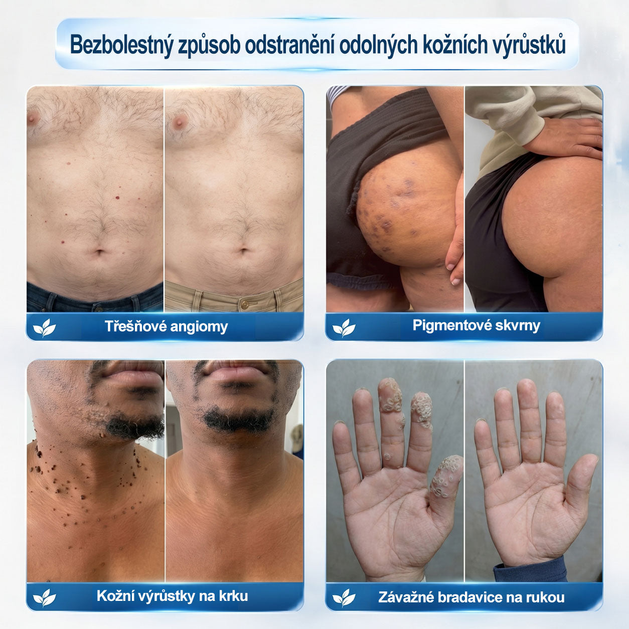 Oficiální značkový obchod |👩‍⚕️𝐏𝐢𝐜𝑑𝑜® 𝟩𝖽𝖾𝗻𝗻í 𝘰𝘥𝘴𝘵𝗋𝖺ň𝗈𝗏𝖺č 𝒔𝒌𝒗𝒓𝙣 𝙖 𝙥𝙞𝙜𝙢𝙚𝙣𝙩𝘰𝘷ý𝘤𝘩 𝘴𝘬𝖛𝖗𝖓 (Bezbolestný rollerball bez jizev)✈️