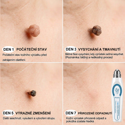Oficiální značkový obchod |👩‍⚕️𝐏𝐢𝐜𝑑𝑜® 𝟩𝖽𝖾𝗻𝗻í 𝘰𝘥𝘴𝘵𝗋𝖺ň𝗈𝗏𝖺č 𝒔𝒌𝒗𝒓𝙣 𝙖 𝙥𝙞𝙜𝙢𝙚𝙣𝙩𝘰𝘷ý𝘤𝘩 𝘴𝘬𝖛𝖗𝖓 (Bezbolestný rollerball bez jizev)✈️