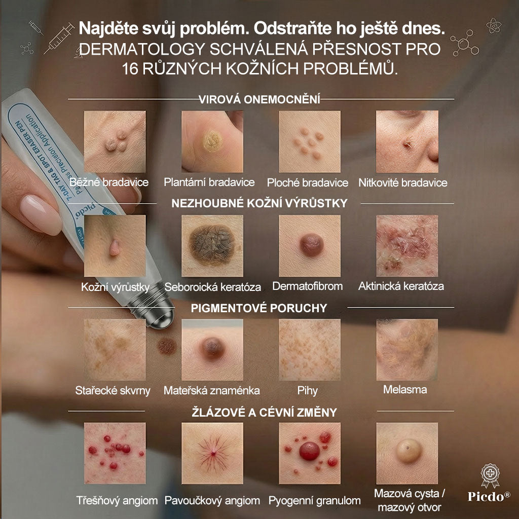 Oficiální značkový obchod |👩‍⚕️𝐏𝐢𝐜𝑑𝑜® 𝟩𝖽𝖾𝗻𝗻í 𝘰𝘥𝘴𝘵𝗋𝖺ň𝗈𝗏𝖺č 𝒔𝒌𝒗𝒓𝙣 𝙖 𝙥𝙞𝙜𝙢𝙚𝙣𝙩𝘰𝘷ý𝘤𝘩 𝘴𝘬𝖛𝖗𝖓 (Bezbolestný rollerball bez jizev)✈️